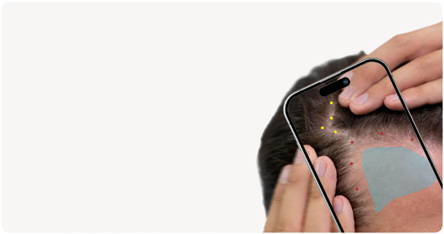 AI Scalp Analysis Free 01