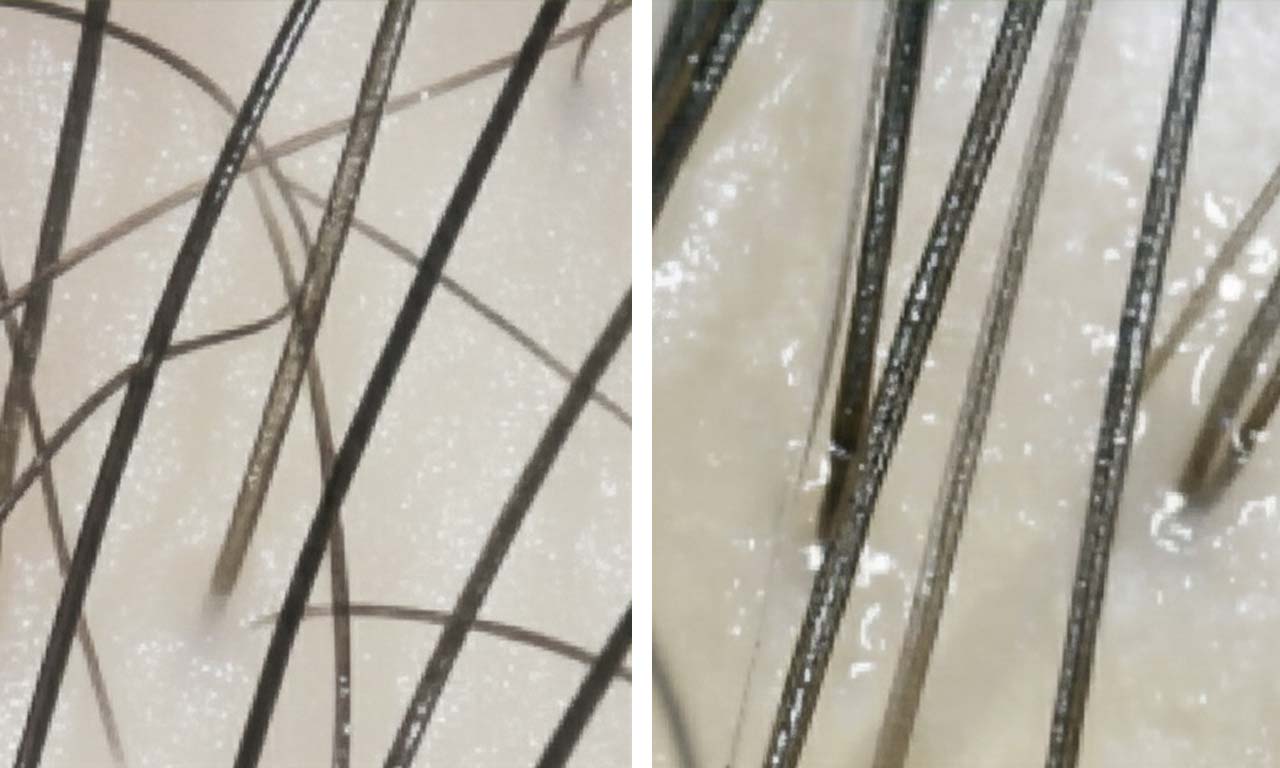 why my scalp becomes oily