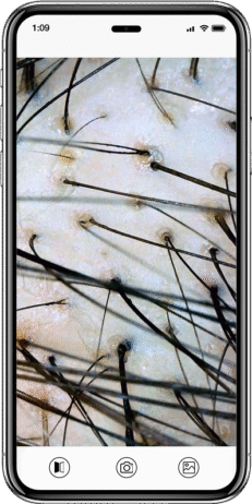 digital microscope phone