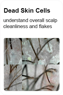 hair dead skin cells