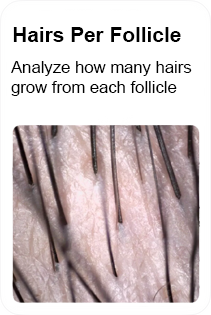 hair per follicle to grow