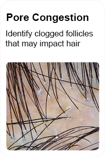 hair pore clogged follicles