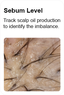 sebum level in scalp