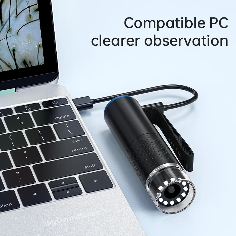 WiFi Digital Microscope for Hair and Scalp Analysis 6 WiFi Digital Microscope for Hair and Scalp Analysis - Image 4